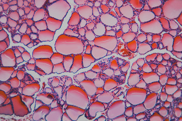 Macro cell-  thyroid gland dog
