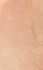 Fototapeta premium skin texture with a light shade of hair