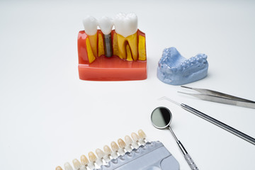 Dental Tools Clear Aligner And Implant Model