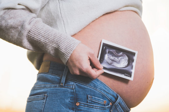 A pregnant woman is holding a photo of her baby Ultrasound , outdoors .