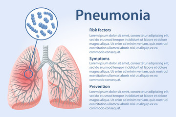 Page template with image of Streptococcus pneumoniae bacteria infected lungs, text on Pneumoniae symptoms, risk of disease and preventive measures. Vector illustration in flat style.