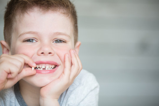 Teenager child with a tooth dropped out