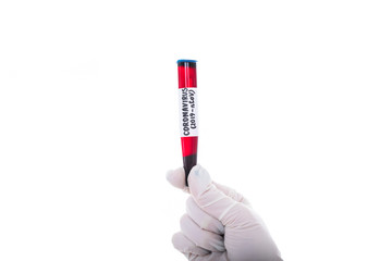 Close-up of a gloved hand holding a test tube containing the blood of a new coronavirus