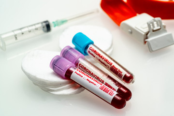 Obraz premium Coronavirus blood test . Coronavirus positive blood in laboratory. 2019-nCoV Coronavirus originating in Wuhan, China