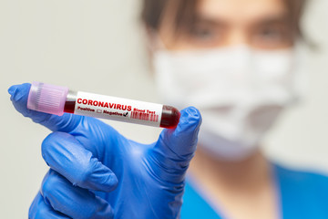 Nurse holding test tube with blood for 2019-nCoV analyzing. Coronavirus negative blood in laboratory.