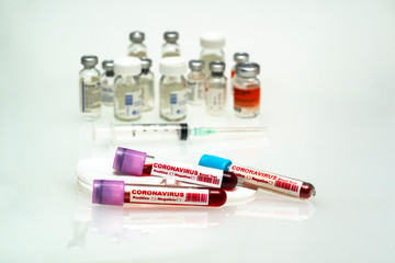 Coronavirus blood test . 2019-nCoV Coronavirus originating in Wuhan, China
