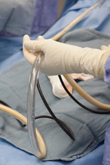 Plastic Surgeon Performing Liposuction and Showing Fat in the Suction Tubes