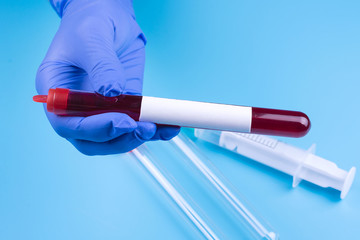 Doctor's hand in a medical glove. Blood sample in a test tube for analysis on a blue. Copy...