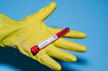Medical laboratory assistant holding test tube with positive Coronavirus test blood sample.