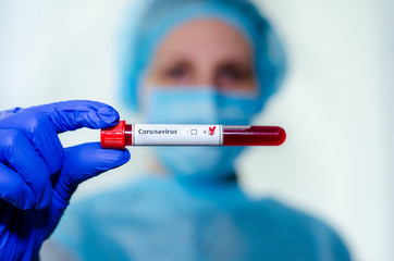 Medical laboratory assistant holding test tube with positive Coronavirus test blood sample.
