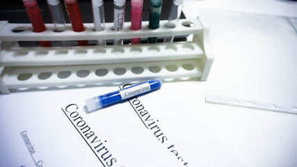 coronavirus test, search for an epidemic vaccine