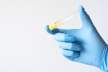 Doctor, nurse or scientist hand holding coronavirus lab tube, medicine and drug concept
