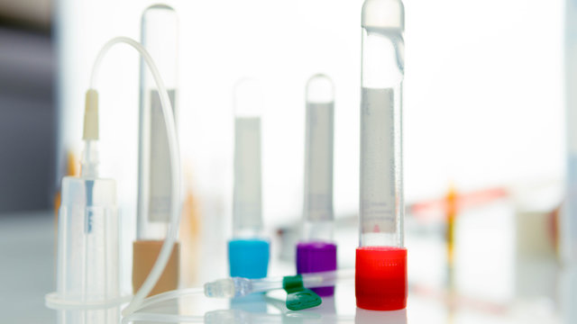 Tubos de an&aacute;lisis varios colores y tipos