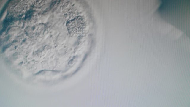 A cell moving under a microscope in laboratory. Ivf, In Vitro Fertilisation Through A Microscope.