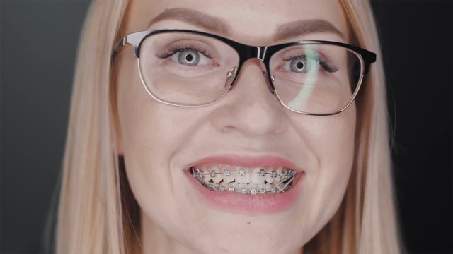 Attractive blonde hair business woman in glasses is looking at camera and smiles to show teeth braces standing at black background. Orthodontic treatment concept. Slowmotion closeup portrait 4K video