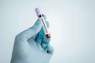 Scientist holding blood sample in test tube in front of blue background. Epidemic Mers-CoV...
