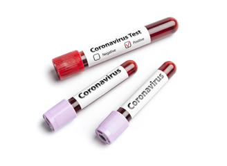 Macro blood samples in three test tubes on white background. One of them with positive diagnosis result marked.  Epidemic Mers-CoV Coronavirus researching and treatment concept.