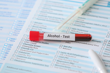 Test tube with blood sample of drunk human on table in clinic