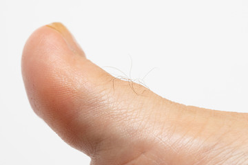 Epilation of unwanted foot hair. Macro of the big toe of a Caucasian woman