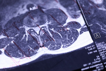 Analysis for medical conclusion