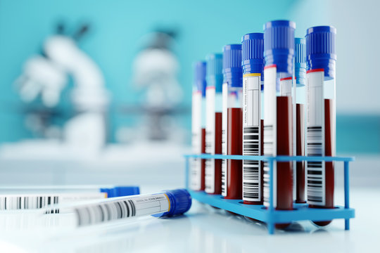 A row of human blood samples in a medical laboratory ready to be tested. healthcare background 3D illustration.