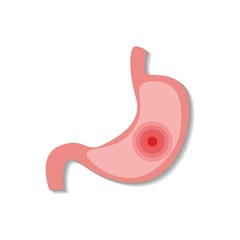 Cartoon stomach illustrations for doctors.