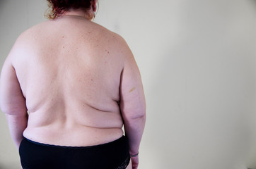 Fat woman, back view