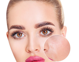 Young woman with zoom circle before and after treatment.