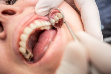 Dentista revisando dentadura de paciente - obrazy, fototapety, plakaty