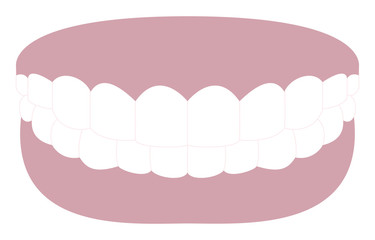 審美歯科、白い歯と黒ずんだ歯茎のイラスト
