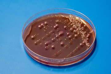 bacterial colonies   on  agar   medium petri dish plate plate on MacConkey agar