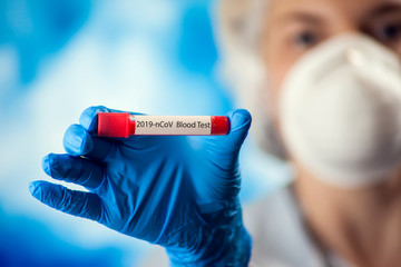 Female doctor holding test tube with blood. Coronavirus, epidemic and healthcare concept