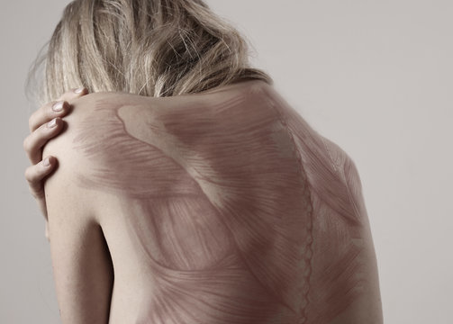 Back pain, female Scoliosis Spine curve Anatomy,