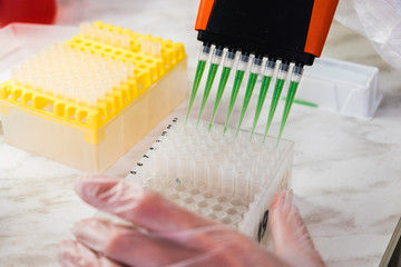 A scientist uses a multi-pipette for research in the laboratory. Working with chemicals. Scientific...