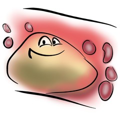 Atherosclerotic plaque in a blood vessel
