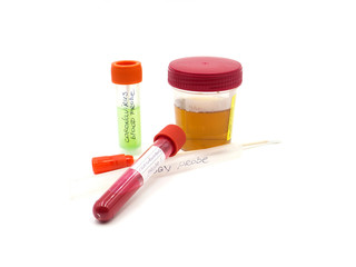 Scientist holding blood samples in test tubes. Group of virus cells around test tube. Epidemic...
