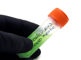  test for coronavirus. Test tubes with blood