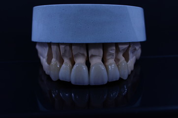 Aesthetic ceramic crown with mirror black background