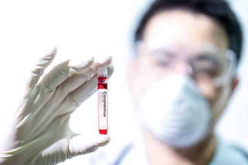 Doctor Hand holding test tube. Coronavirus laboratory testing. Asian doctors holding Coronavirus 2019-nCoV Blood sample that cause mysterious viral in China (Wuhan City)