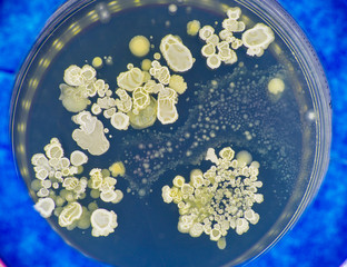 Tests for skin fungal diseases. Samples of fungus causing skin diseases grown in a petri dish