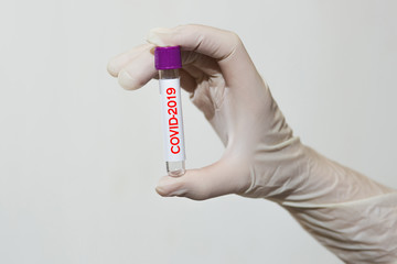 a doctor in a white coat, with a phonendoscope around her neck and gloves, holds a positive blood test for coronavirus COVID-2019. test tube with virus analysis