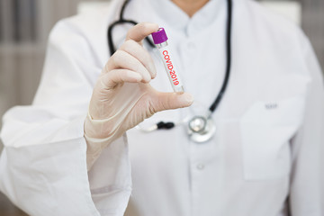 a doctor in a white coat, with a phonendoscope around her neck and gloves, holds a positive blood test for coronavirus COVID-2019. test tube with virus analysis
