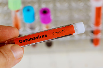 Obraz premium Coronavirus blood test Covid-19, 2019-nCoV,SARS-CoV, MERS-CoV blood test in Laboratory