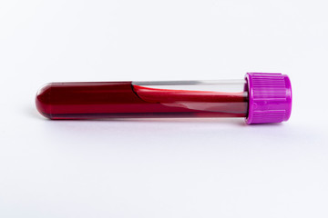 Tube with blood for blood test. White background.