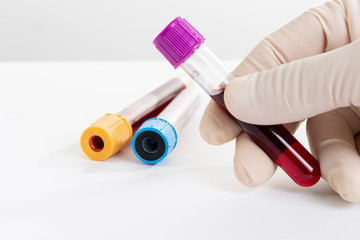 Doctor holding blood test tube.