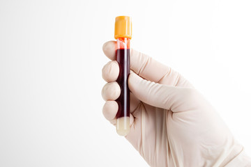 Doctor showing tube with blood for examination on white background.