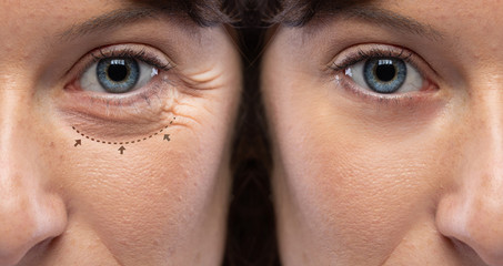 Half face of a girl with dark hair and blue eyes