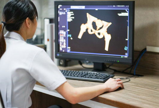 Radiotechnologist hand holding mouse while working on CT scan workstaion with 3D VRT hip bone reconstruction background.