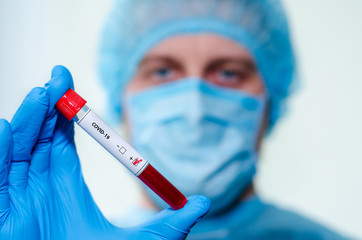 Medical laboratory assistant holding test tube with positive Coronavirus test blood sample.