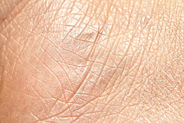 Dry and cracked skin of caucasian lady closeup, rehydrating and rejuvenate treatment concept